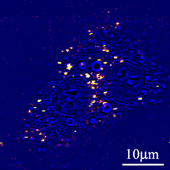 Two-photon autofluorescence image of a live cell incubated with gold nanoparticles, superimposed on a simple transmission image of the cell